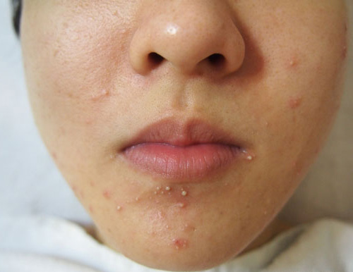 dermafortevietnam_post8.1.jpg